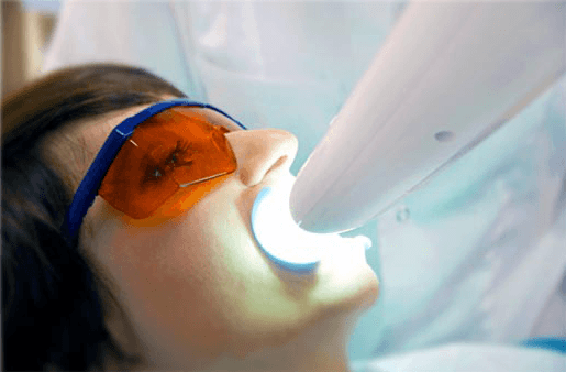 Understanding the Causes of Teeth Sensitivity Bicester