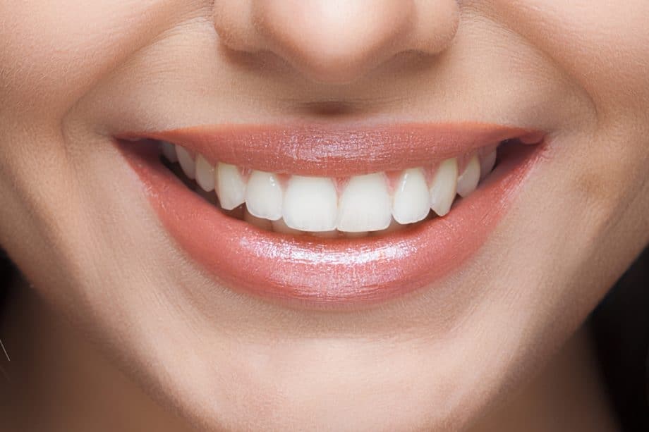 Beyond Whitening: How Your Daily Diet Affects Long-Term Smile Brightness Bicester
