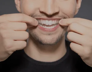 Overview of Home Teeth Whitening Kits Bicester