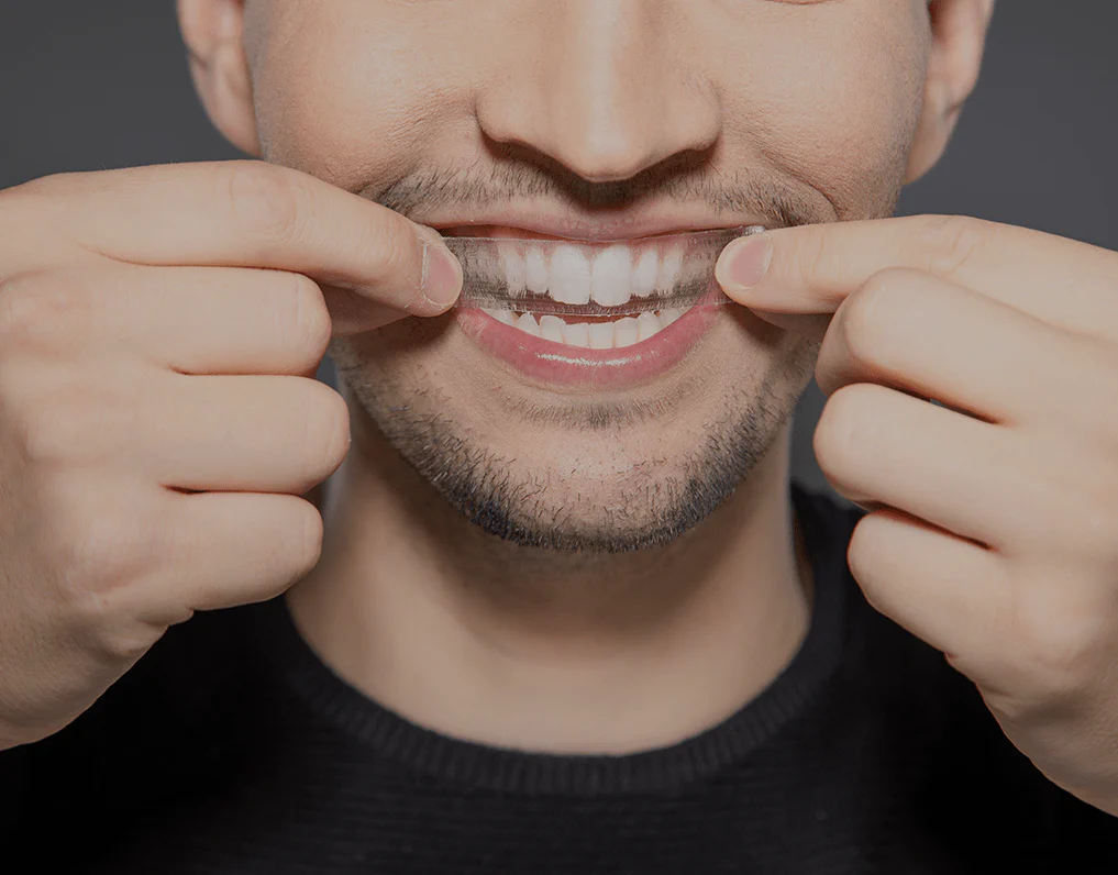 Can You Whiten Natural Teeth Without Harsh Chemicals Bicester?