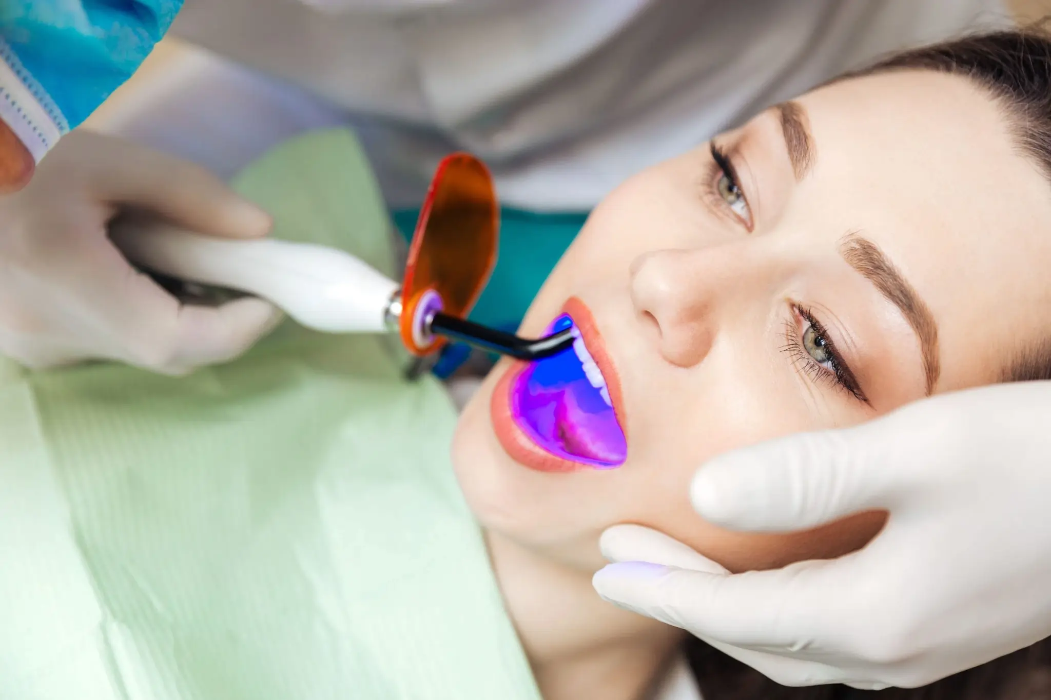 When Should You Stop DIY Whitening and Consider Professional Treatment Instead Bicester?