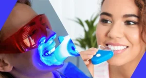 Impact of Home Kits Bicester versus Professional Teeth Whitening Treatments