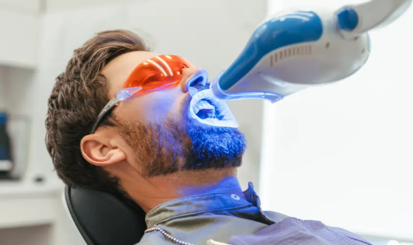 Who Should Avoid Laser Teeth Whitening Due to Higher Risk Factors Bicester?