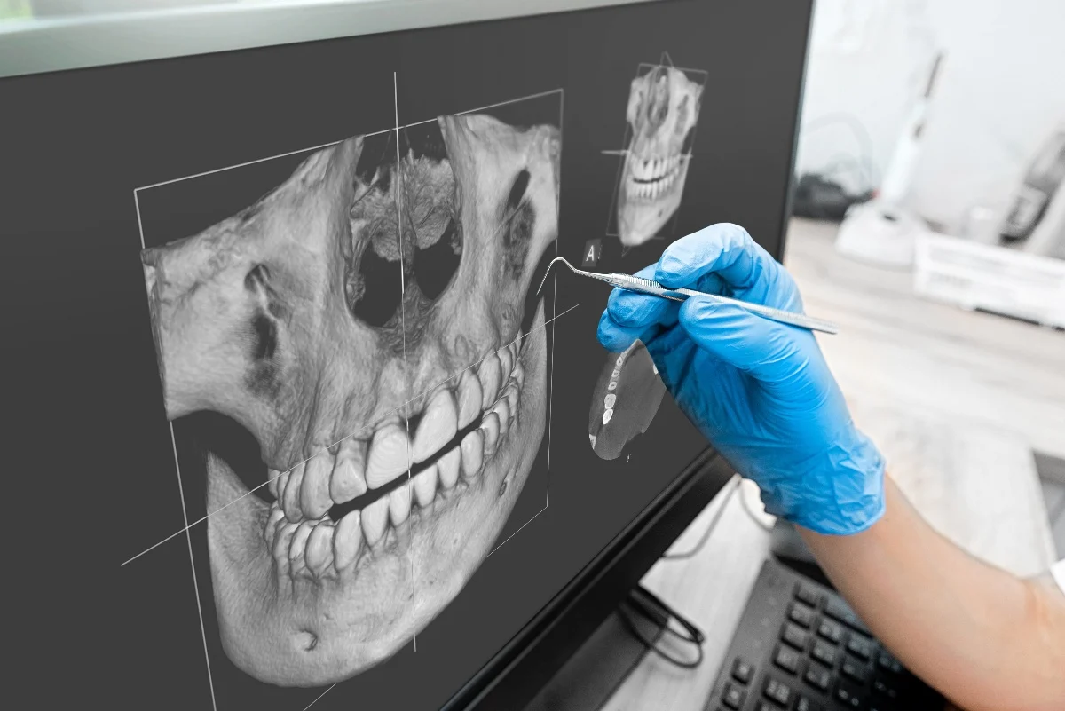 How Is AI Transforming Dental Treatment Planning Bicester?