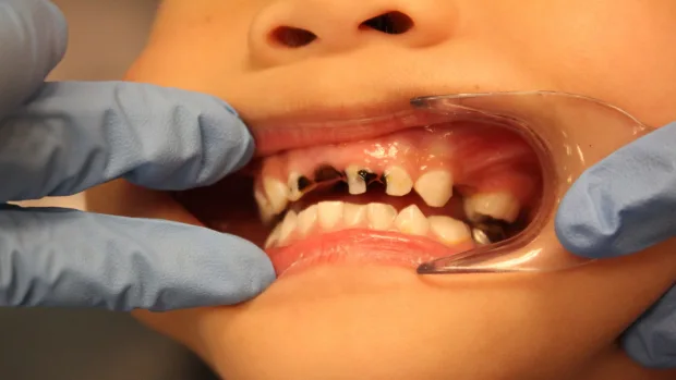 Can Your Diet Help You Achieve a Whiter, Healthier Smile Bicester?