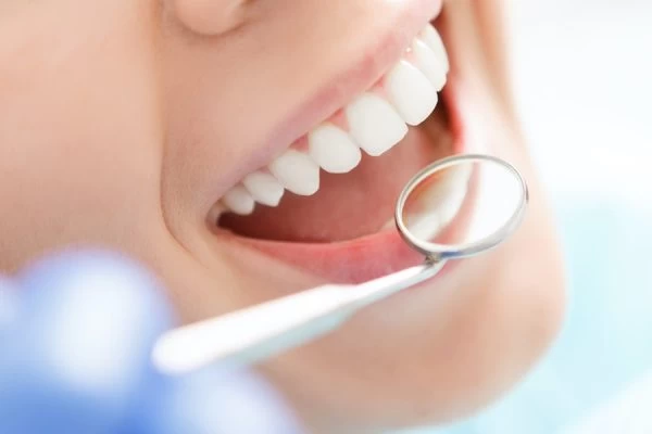 How Much Fluoride Do You Really Need Bicester?
