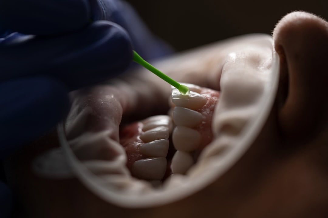 Common Causes of Persistent Dry Mouth Bicester