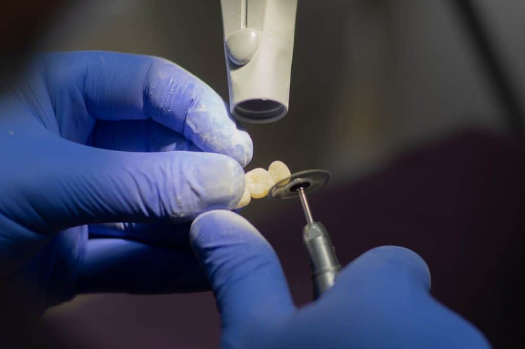 Customised Dental Solutions: Crowns, Aligners, and Implants Bicester