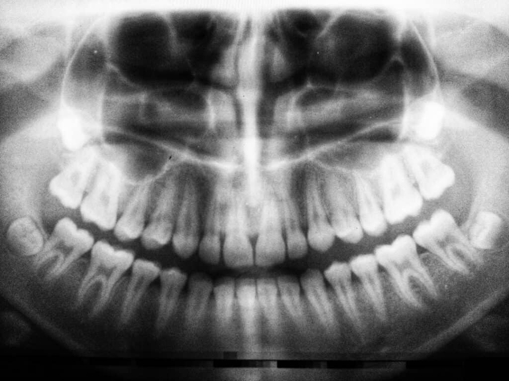 The Future of 3D Printing in Oral Healthcare Bicester